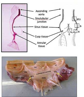 Which Biological Properties of Heart Valves Are Relevant to Tissue Engineering?